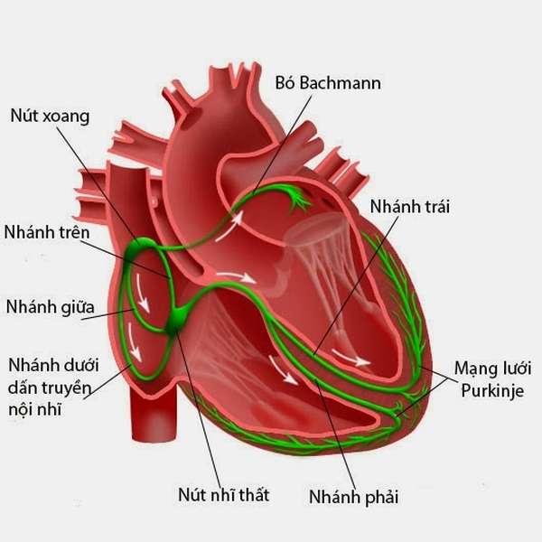 Ảnh 2 của Infective endocarditis